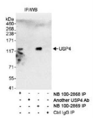 Immunoprecipitation: USP4 Antibody [NB100-2868] - Detection of Human USP4 by Western Blot of  Immunoprecipitates.  Samples:  Whole cell lysate (1 mg for IP,  20% of IP loaded) from HeLa cells.  Antibodies:  Affinity purified  rabbit anti-USP4 antibody NB100-2868 used  for IP at 3 mcg/mg lysate. USP4 was also immunoprecipitated  by rabbit anti-USP4 antibody NB100-2869,  which recognizes a downstream epitope.  Detection: Chemiluminescence with an  exposure time of 30 seconds.