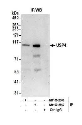 <b>Independent Antibodies Validation and Biological Strategies Validation.</b>Immunoprecipitation: USP4 Antibody [NB100-2869] - Detection of human USP4 by western blot of immunoprecipitates. Samples: Whole cell lysate (0.5 or 1.0 mg per IP reaction; 20% of IP loaded) from HeLa cells prepared using NETN lysis buffer. Antibodies: Affinity purified rabbit anti-USP4 antibody NB100-2869 used for IP at 6 ug per reaction. USP4 was also immunoprecipitated by rabbit anti-USP4 antibody NB100-2868. For blotting immunoprecipitated USP4, NB100-2869 was used at 1 ug/ml. Detection: Chemiluminescence with an exposure time of 30 seconds.