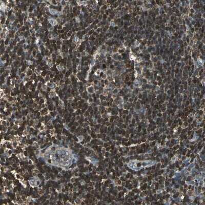 Immunohistochemistry-Paraffin: USP40 Antibody [NBP1-90426] - Staining of human tonsil shows strong cytoplasmic positivity in reaction center cells and lymphoid cells outside reaction centra.