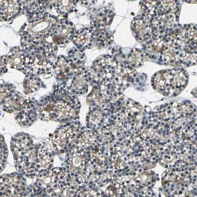 Immunohistochemistry-Paraffin: USP40 Antibody [NBP1-90426] - Staining of human parathyroid gland shows moderate cytoplasmic positivity in glandular cells.