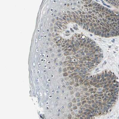 Immunohistochemistry-Paraffin: USP40 Antibody [NBP1-90426] - Staining of human skin shows moderate cytoplasmic positivity in squamous epithelial cells.