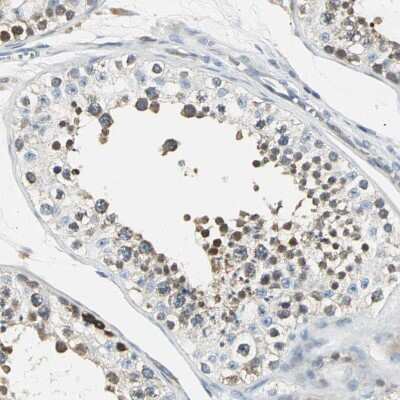 Immunohistochemistry-Paraffin: USP40 Antibody [NBP1-90426] - Staining of human testis shows strong cytoplasmic positivity in cells in seminiferous ducts.