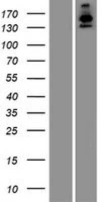 Western Blot: USP40 Overexpression Lysate (Adult Normal) [NBP2-06843] Left-Empty vector transfected control cell lysate (HEK293 cell lysate); Right -Over-expression Lysate for USP40.