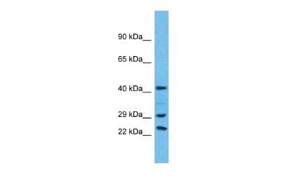 Western Blot: USP41 Antibody [NBP3-09906] - Western blot analysis of USP41 in Hela Whole Cell lysates. Antibody dilution at 1.0ug/ml