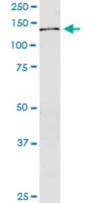 Western Blot: USP45 Antibody (1H2) [H00085015-M01] - USP45 monoclonal antibody (M01), clone 1H2. Analysis of USP45 expression in human pancreas.