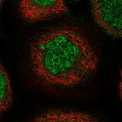 Immunocytochemistry/Immunofluorescence: USP45 Antibody [NBP1-81200] - Immunofluorescent staining of human cell line A-431 shows localization to nucleoplasm & cytosol.