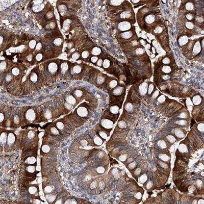 Immunohistochemistry-Paraffin: USP45 Antibody [NBP1-81201] - Staining of human small intestine shows strong cytoplasmic positivity in glandular cells.