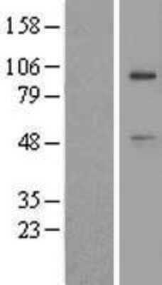 Western Blot: USP45 Overexpression Lysate (Adult Normal) [NBL1-17666] Left-Empty vector transfected control cell lysate (HEK293 cell lysate); Right -Over-expression Lysate for USP45.