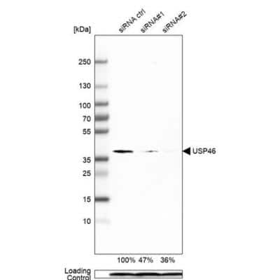 Western Blot: USP46 Antibody (CL0363) [NBP2-52923] - Analysis in U-251MG cells transfected with control siRNA, target specific siRNA probe #1 and #2, using Anti-USP46 antibody. Remaining relative intensity is presented. Loading control: Anti-PPIB.