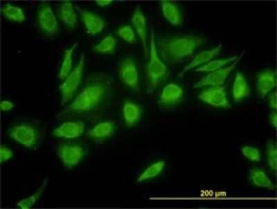 Immunocytochemistry/Immunofluorescence: USP47 Antibody (5F9) [H00055031-M01] - Analysis of monoclonal antibody to USP47 on HeLa cell. Antibody concentration 10 ug/ml.