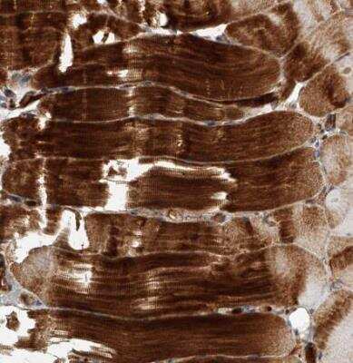 Immunohistochemistry-Paraffin USP47 Antibody - BSA Free