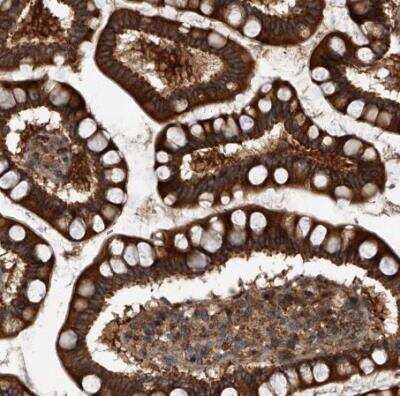Immunohistochemistry-Paraffin USP47 Antibody - BSA Free