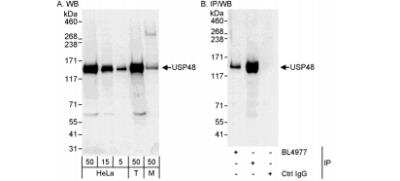 Western Blot: USP48 Antibody [NB100-59838] - Detection of Human and Mouse USP48 on HeLa whole cell lysate using NB100-59838. USP48 was also immunoprecipitated by another rabbit anti-USP48 antibody.
