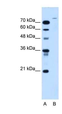 Western Blot: USP48 Antibody [NBP1-59752] - HepG2 cell lysate, concentration 2.5 ug/ml.