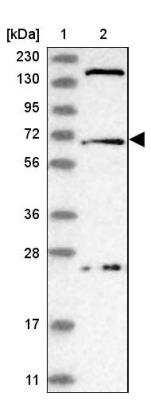 Western Blot: USP49 Antibody [NBP1-81173] - Lane 1: Marker  [kDa] 230, 130, 95, 72, 56, 36, 28, 17, 11.  Lane 2: Human cell line RT-624