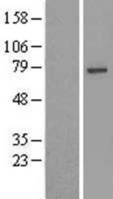 Western Blot: USP49 Overexpression Lysate (Adult Normal) [NBL1-17668] Left-Empty vector transfected control cell lysate (HEK293 cell lysate); Right -Over-expression Lysate for USP49.