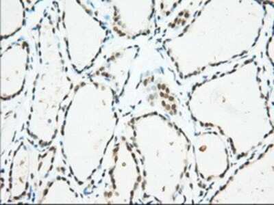 Immunohistochemistry-Paraffin: USP5 Antibody (2E3) [NBP2-02648] - Staining of paraffin-embedded Human thyroid tissue using anti-USP5 mouse monoclonal antibody.