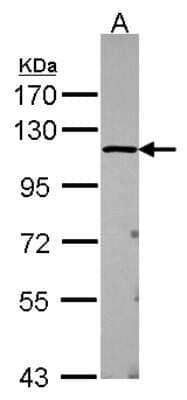 Western Blot: USP5 Antibody [NBP2-20838] - Sample (30 ug of whole cell lysate) A: Raji 7. 5% SDS PAGE gel, diluted at 1:1000.
