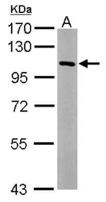 Western Blot: USP5 Antibody [NBP2-20838] - Sample (50 ug of whole cell lysate) A: Mouse Brain, 7. 5% SDS PAGE gel, diluted at 1:1000.