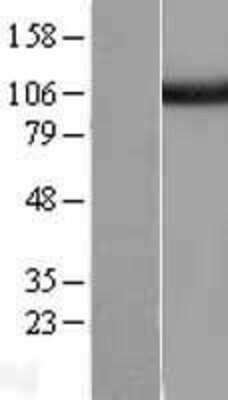 Western Blot Isopeptidase T/USP5 Overexpression Lysate