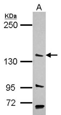 Western Blot: USP52 Antibody [NBP2-15062] - Sample (30 ug of whole cell lysate) A: Jurkat 5% SDS PAGE; antibody diluted at 1:1000.