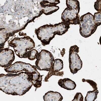 Immunohistochemistry-Paraffin: USP53 Antibody [NBP2-32710] - Staining of human placenta shows strong cytoplasmic positivity in trophoblastic cells.