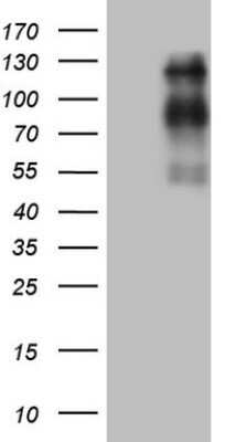 Western Blot: USP53 Antibody (OTI3C9) - Azide and BSA Free [NBP2-74812] - Analysis of HEK293T cells were transfected with the pCMV6-ENTRY control (Left lane) or pCMV6-ENTRY USP53.