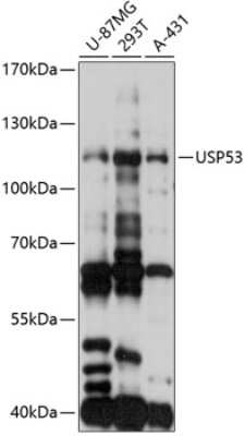 Western Blot: USP53 Antibody [NBP3-05172] - Analysis of extracts of various cell lines, using USP53 antibody at 1:3000 dilution. Secondary antibody: HRP Goat Anti-Rabbit IgG (H+L) at 1:10000 dilution. Lysates/proteins: 25ug per lane. Blocking buffer: 3% nonfat dry milk in TBST. Detection: ECL Basic Kit