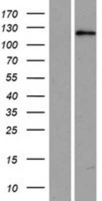 Western Blot USP53 Overexpression Lysate