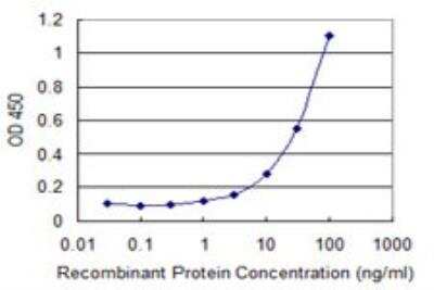 ELISA: USP6 Antibody (1F5) [H00009098-M01] - Detection limit for recombinant GST tagged USP6 is 1 ng/ml as a capture antibody.