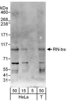 Western Blot: USP6NL Antibody [NBP1-47264] - Whole cell lysate from HeLa (5, 15 and 50 ug) and 293T (T; 50 ug) cells. Antibody used at 0.4 ug/ml.