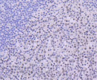 Immunohistochemistry-Paraffin: USP7 Antibody (JB80-36) [NBP2-75703] - Analysis of paraffin-embedded human tonsil tissue using anti-USP7 antibody. Counter stained with hematoxylin.