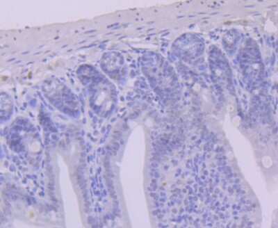 Immunohistochemistry-Paraffin: USP7 Antibody (JB80-36) [NBP2-75703] - Analysis of paraffin-embedded mouse colon tissue using anti-USP7 antibody. Counter stained with hematoxylin.