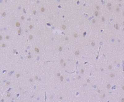 Immunohistochemistry-Paraffin: USP7 Antibody (JB80-36) [NBP2-75703] - Analysis of paraffin-embedded rat brain tissue using anti-USP7 antibody. Counter stained with hematoxylin.