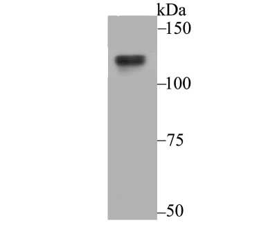 Western Blot: USP7 Antibody (JB80-36) [NBP2-75703] - Analysis of USP7 on 293T cell using anti-USP7 antibody at 1/500 dilution.