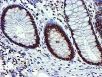 Immunohistochemistry: USP7 Antibody (OTI1F12) - Azide and BSA Free [NBP2-74814] - Staining of paraffin-embedded Human colon tissue using anti-USP7 mouse monoclonal antibody.