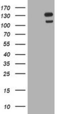 Western Blot: USP7 Antibody (OTI1F12) - Azide and BSA Free [NBP2-74814] - HEK293T cells were transfected with the pCMV6-ENTRY control (Left lane) or pCMV6-ENTRY USP7 (Right lane) cDNA for 48 hrs and lysed. Equivalent amounts of cell lysates (5 ug per lane) were separated by SDS-PAGE and immunoblotted with anti-USP7.