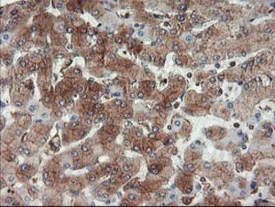 Immunohistochemistry: USP9x Antibody (OTI2G7) - Azide and BSA Free [NBP2-74822] - Staining of paraffin-embedded Human liver tissue using anti-USP9x mouse monoclonal antibody.