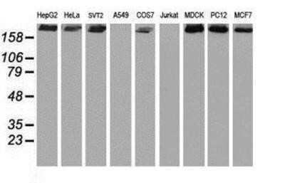 Western Blot: USP9x Antibody (OTI2G7) - Azide and BSA Free [NBP2-74822] - Analysis of extracts (35ug) from 9 different cell lines by using g anti-USP9x monoclonal antibody (HepG2: human; HeLa: human; SVT2: mouse; A549: human; COS7: monkey; Jurkat: human; MDCK: canine; PC12: rat; MCF7: human).