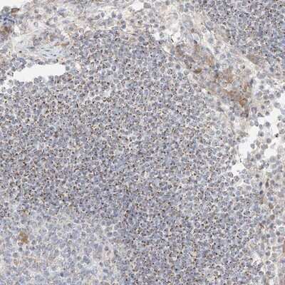 Immunohistochemistry-Paraffin: UST Antibody [NBP1-89383] - Staining of human lymph node shows moderate granular positivity in cells outside reaction centra.