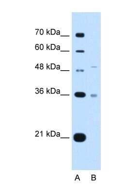 Western Blot: UST Antibody [NBP1-60042] - HepG2 tissue lysate at a concentration of 2.5ug/ml.