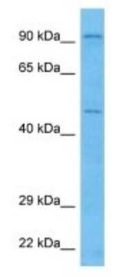 Western Blot: UST Antibody [NBP3-10107] - Western blot analysis of UST in Mouse Lung lysates. Antibody dilution at 1ug/ml