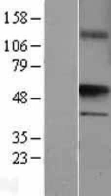 Western Blot: UST Overexpression Lysate (Adult Normal) [NBL1-17674] Left-Empty vector transfected control cell lysate (HEK293 cell lysate); Right -Over-expression Lysate for UST.