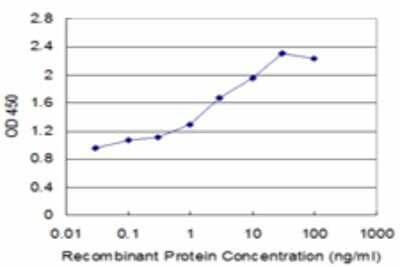 Sandwich ELISA UT2/SLC14A2 Antibody (3E7)