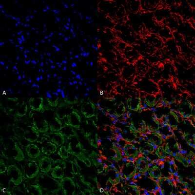 Immunohistochemistry-Paraffin UT2/SLC14A2 Antibody