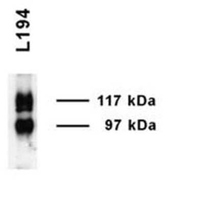 Western Blot UT2/SLC14A2 Antibody