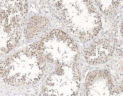 Immunohistochemistry-Paraffin: UTF1 Antibody [NBP3-12788] - Staining of human UTF1 in human testis with rabbit polyclonal antibody at 1:300 dilution.