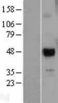 Western Blot: UTF1 Overexpression Lysate (Adult Normal) [NBL1-17675] Left-Empty vector transfected control cell lysate (HEK293 cell lysate); Right -Over-expression Lysate for UTF1.