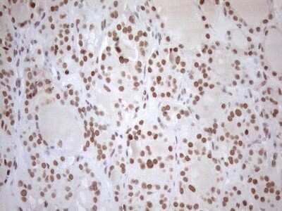 Immunohistochemistry: UTP11L Antibody (5F3) [NBP2-46318] - Analysis of Human thyroid tissue. (Heat-induced epitope retrieval by 1mM EDTA in 10mM Tris buffer (pH8.5) at 120C for 3 min)