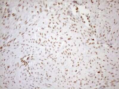 Immunohistochemistry: UTP11L Antibody (5F3) [NBP2-46318] - Analysis of Human endometrium tissue. (Heat-induced epitope retrieval by 1mM EDTA in 10mM Tris buffer (pH8.5) at 120C for 3 min)